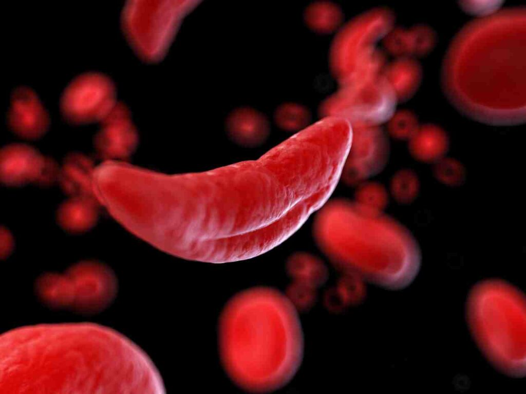 Anemia come riconoscerla facilmente e curarla in modo naturale - GUIDA